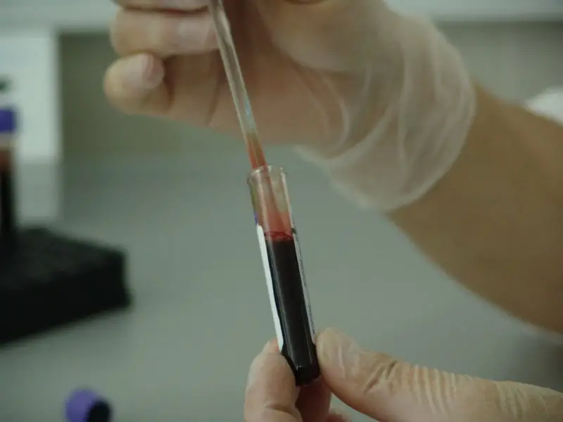 ¿Cuánto cuesta la prueba de sangre para el embarazo sin seguro? ¡Con 3 pruebas útiles!