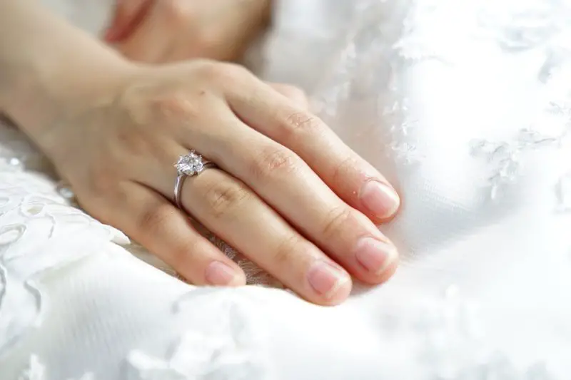 Cómo deshacerse de la erupción del anillo de bodas: 2 formas