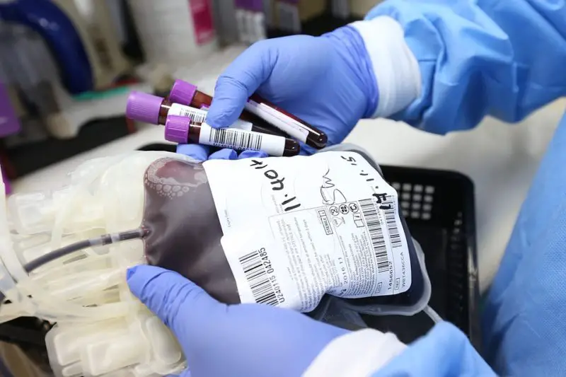 ¿Cómo bajar el hematocrito para la donación de plasma? 6 maneras impresionantes!